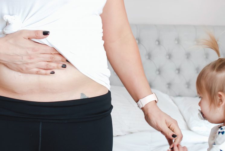 5 Reasons why being a Cesarean mama is badass and why you need to let go of the guilt you have over your birth. | Cesarean | Motherhood | C-Section mom |